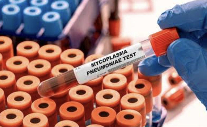 Mycoplasma Pneumoniae
